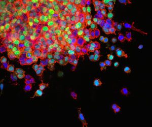 Cancer du poumon : le dépistage organisé en expérimentation