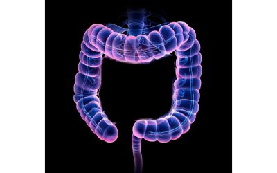 Cancer colorectal : Le syndrome de LYNCH