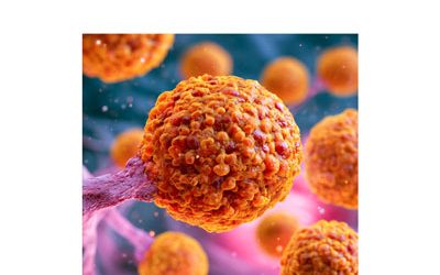 Cancer du pancréas : une histoire de famille ?