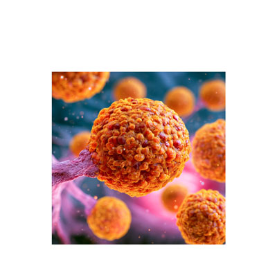 Cancer du pancréas : une histoire de famille ?